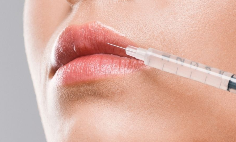 lip filler injection
