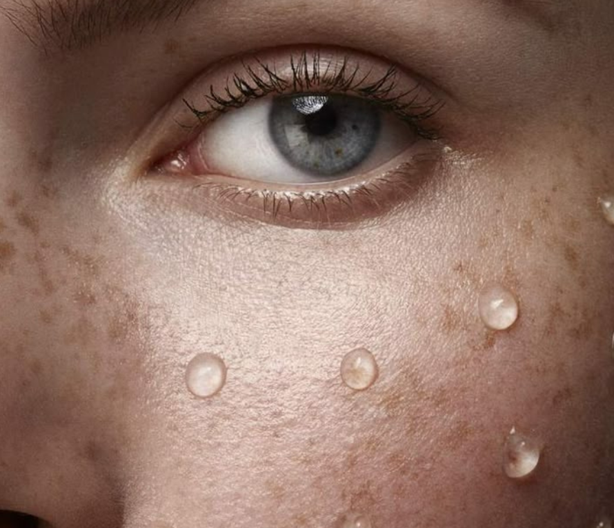 mesotherapy for face